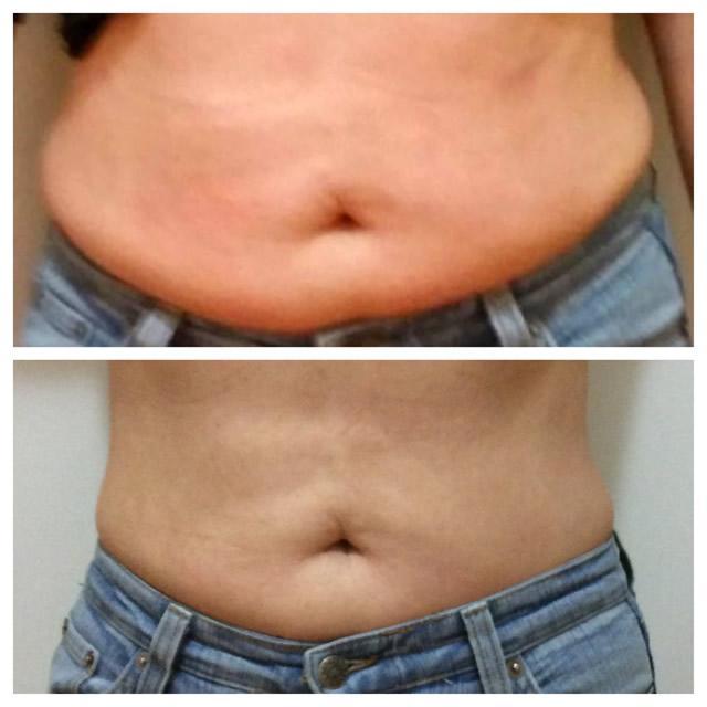 Pink Intimate Treatment Houston