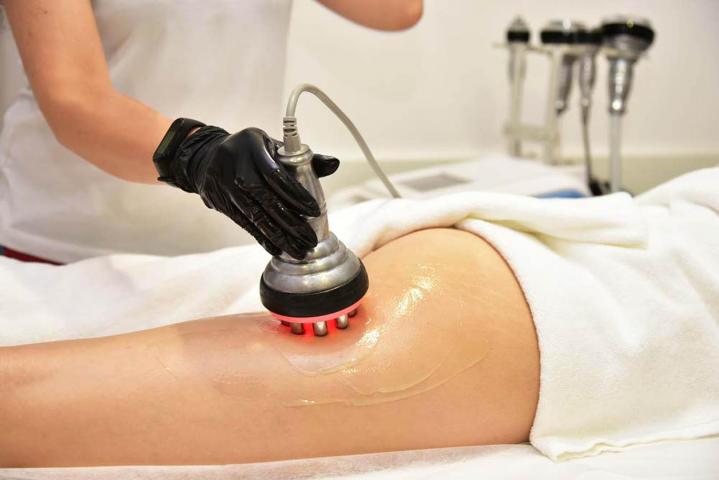 Body Contouring Options Houston