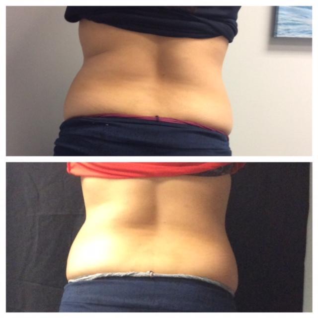 Pink Intimate Treatment Houston