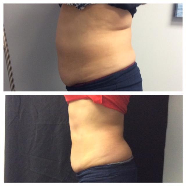 Anti-Aging Solutions Houston