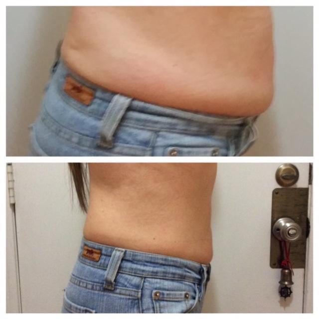 Anti-Aging Treatments Houston