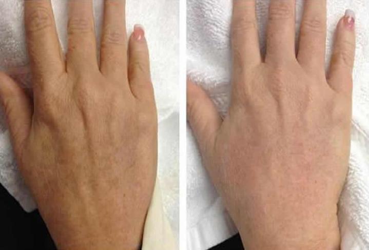 Skin Care Treatments Houston