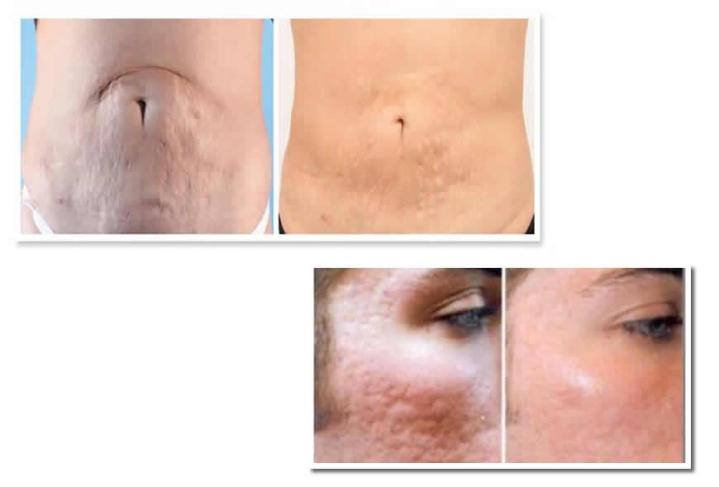 Pink Intimate Treatment Houston