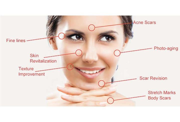 Facial Treatments Houston