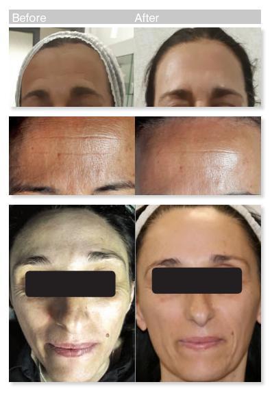 Anti-Aging Solutions Houston