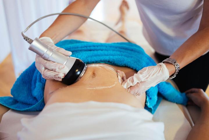 Body Contouring Houston