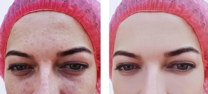 Anti-Aging Treatments Houston