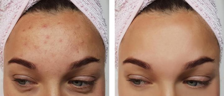 Facial Treatment Options Houston