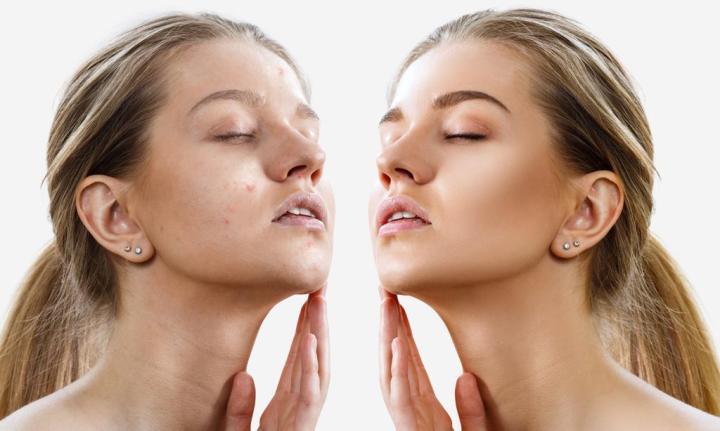 Facial Treatments Houston
